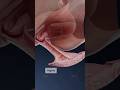 What Is Herpetic Vaginitis And How Does It Affect The Vagina Explore Gynecology In 3D With VOKA What Is Herpetic Vaginitis And How Does It Affect The Vagina Explore Gynecology In 3D With VOKA