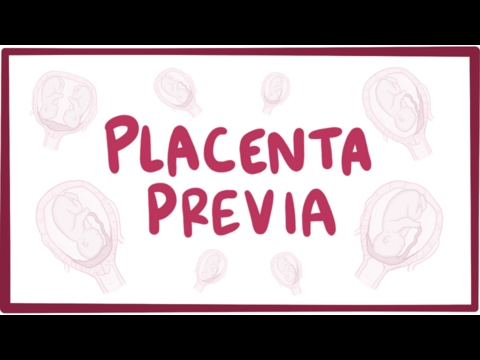 Placenta previa - causes, symptoms, diagnosis, treatment, pathology