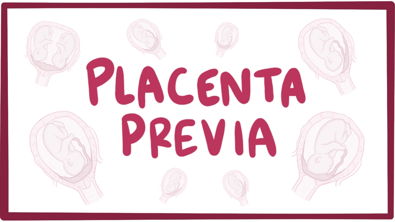 Placenta Previa - Causes, Symptoms, Diagnosis, Treatment, Pathology