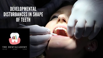Developmental disturbances in shape of teeth-part 1