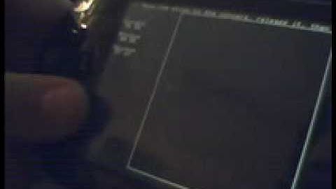 Eloader exploit 6.20