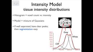 7. Segmentation: FAST (Struc E1)