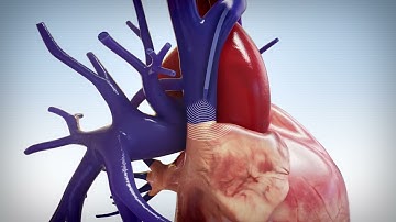 Vps G4 Animation  1278B