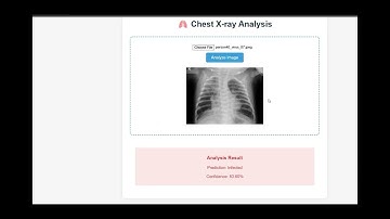 AI-Powered Chest X-Ray Analysis | Transforming Healthcare Diagnostics