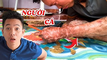Gặp người cá vẽ tranh bằng da, mỗi ngày phải tắm 10 lần để làm dịu cơ thể - ĐỘC LẠ BÌNH DƯƠNG