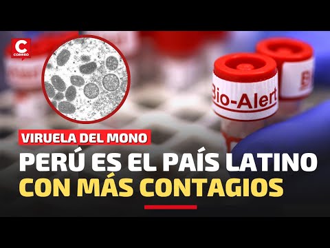VIRUELA DEL MONO: Perú es el país latino con más contagios