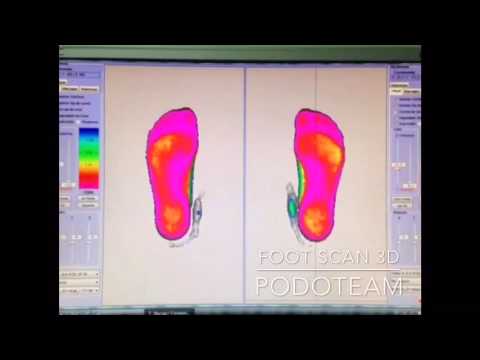 3D Foot Scan Podoteam - YouTube