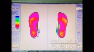 3D Foot Scan Podoteam