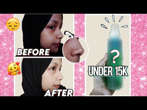 cara-menghilangkan-bruntusan-di-hidung-,-dengan-cepat-|-drugstore