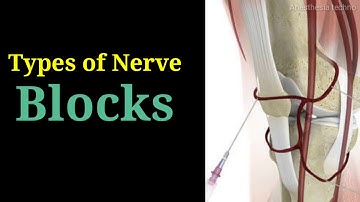 types of nerve blocks.