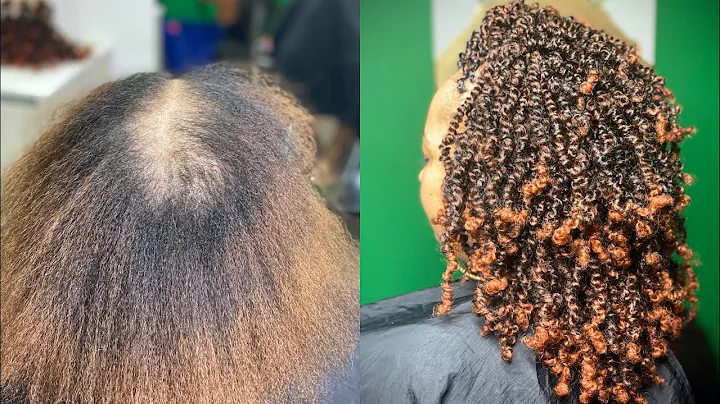 Amazing Spring Twists Hair Transformation for Alopecia Client