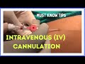 INTRAVENOUS (I.V) CANNULATION (in 5 mins)| How to insert