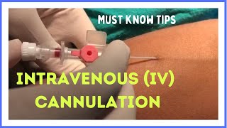 INTRAVENOUS (I.V) CANNULATION (in 5 mins)| How to insert