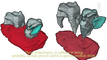 I3M. Dispositivo para visualización simultánea de tejidos blandos y duros