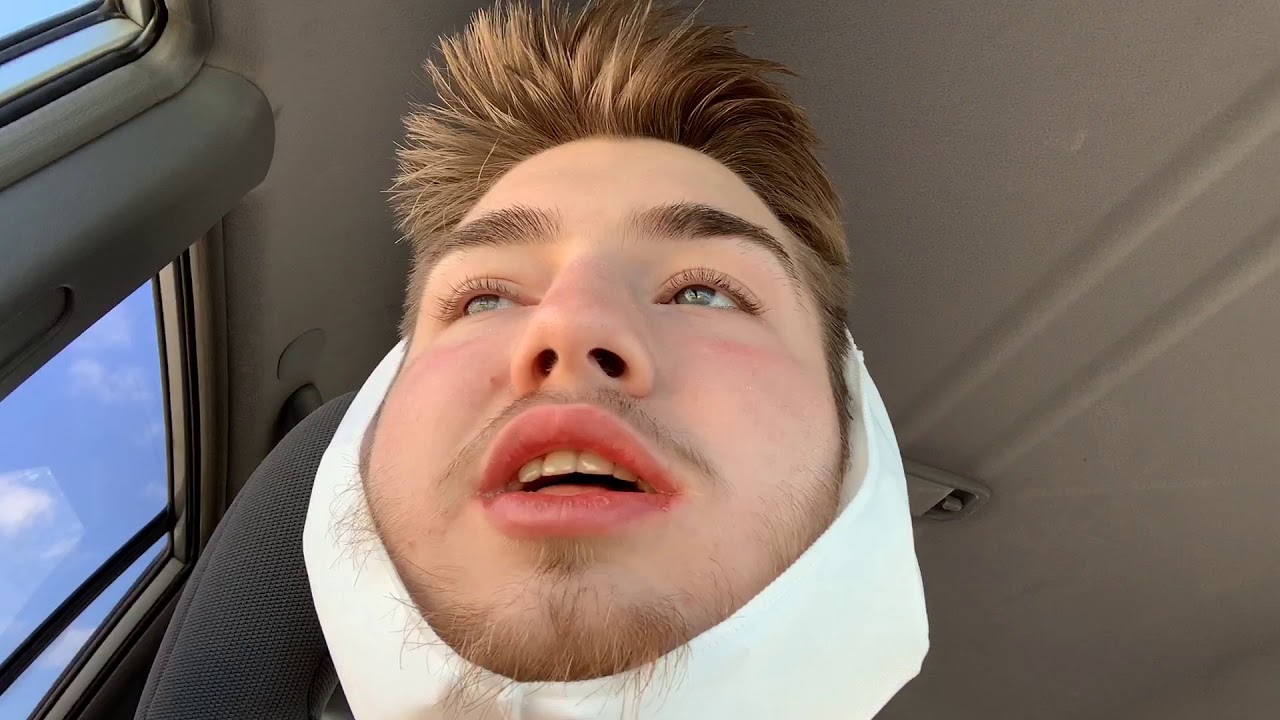 WISDOM TEETH REMOVAL. Vlog#1 - YouTube