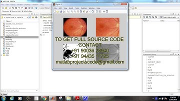 ANALYSIS OF RETINAL BLOOD VESSELS USING IMAGE PROCESSING TECHNIQUES