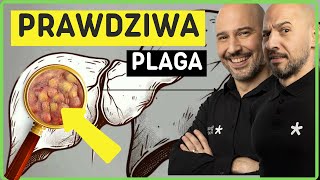 #1 sposób na zdrową wątrobę | unikaj tych produktów |