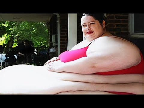 20 Extremely Overweight People You Wont Believe Exist