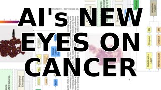 This New AI Sees Cancer by Combining the Big Picture AND the Details