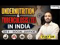 Undernutrition and Tuberculosis (TB) in India | GS II- Social Justice | 9700796000