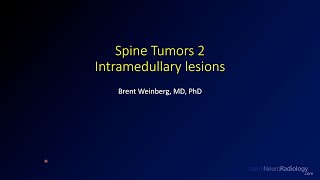 Spine tumors 2 – Intramedullary lesions