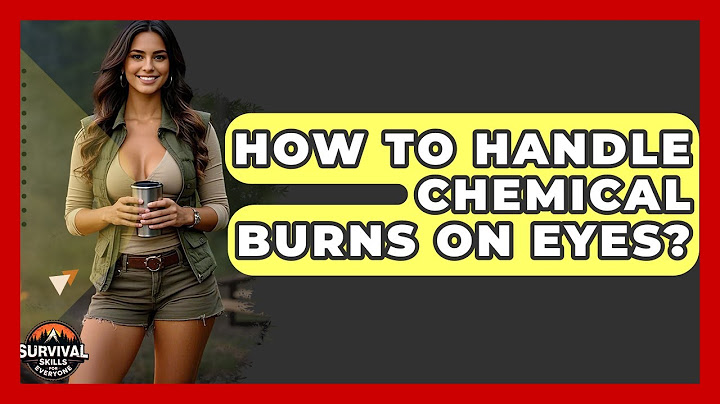 How To Handle Chemical Burns On Eyes? - Survival Skills for Everyone