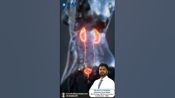 Robotic pyeloplasty surgery ensuring improved patient outcomes and faster recovery.