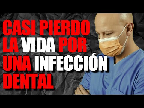 Video: ¿La pulpitis puede causar dolor de oído?