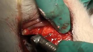 How do we effectively remove the fractured root tip