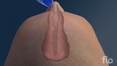 Can Nasal and Sinus Irrigation Help - Health Tips