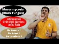 What is Black Fungus Infection/ Mucormycosis? Mucormycosis can be treated or not? (by Dr. Puspendra)