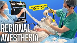 How anesthesiologists numb specific body parts (actual video of a nerve block)