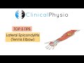 Top 5 Tips: Lateral Epicondylitis (Tennis Elbow) | Clinical Physio