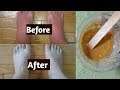 Feet Whitening Miracle Scrub | Takes Off Tan and Dead Skin From Your Feet.