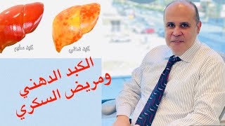 الكبد الدهني بسبب السكر ..يوميات مريض السكر ...تعالي اشرب الشاي بدون سكر