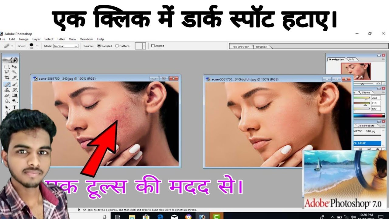 How To Clear Face In Photoshop 7 0 Photoshop Pimples how-to-clear-face-in-photoshop-7-0-photoshop-pimples