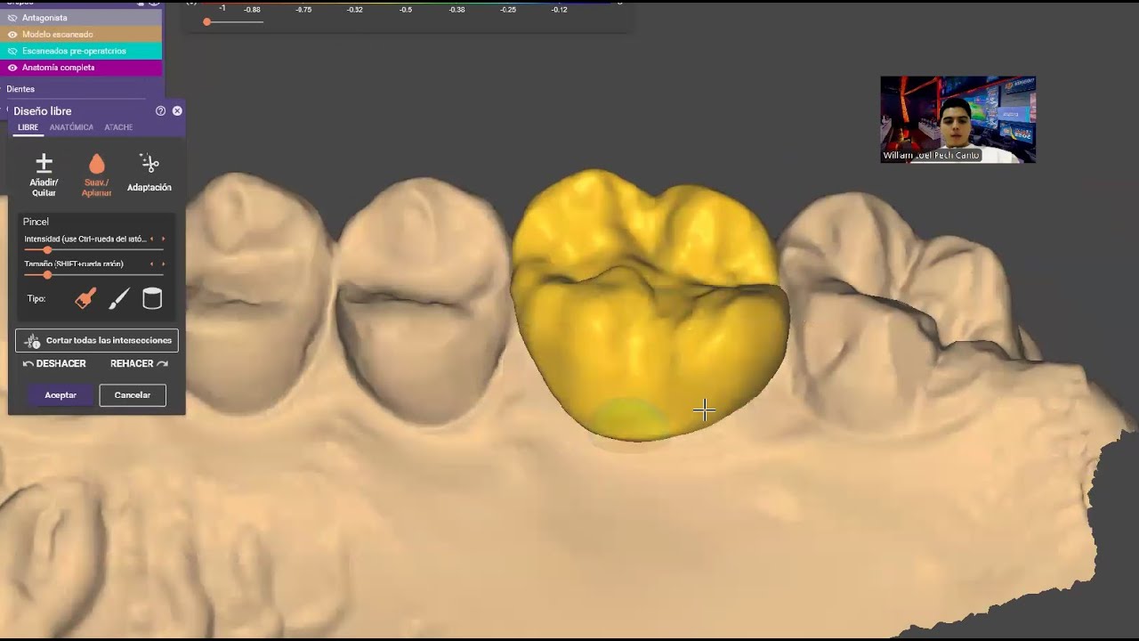 Práctica 5 - Exocad tutorial - Mirror tooth