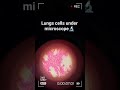 lungs cells under microscopy #biology #shortsfeed #youtubeshorts #educationalvideo #trending