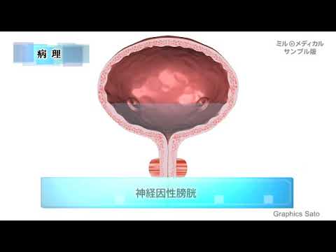 神経因性膀胱／ミルメディカル 家庭の医学 動画版