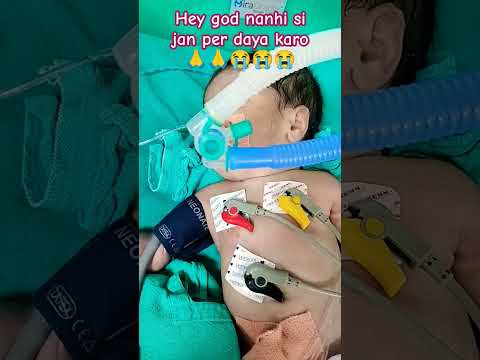 Ventilation Support Baby And Miracradle And Very Sick Baby