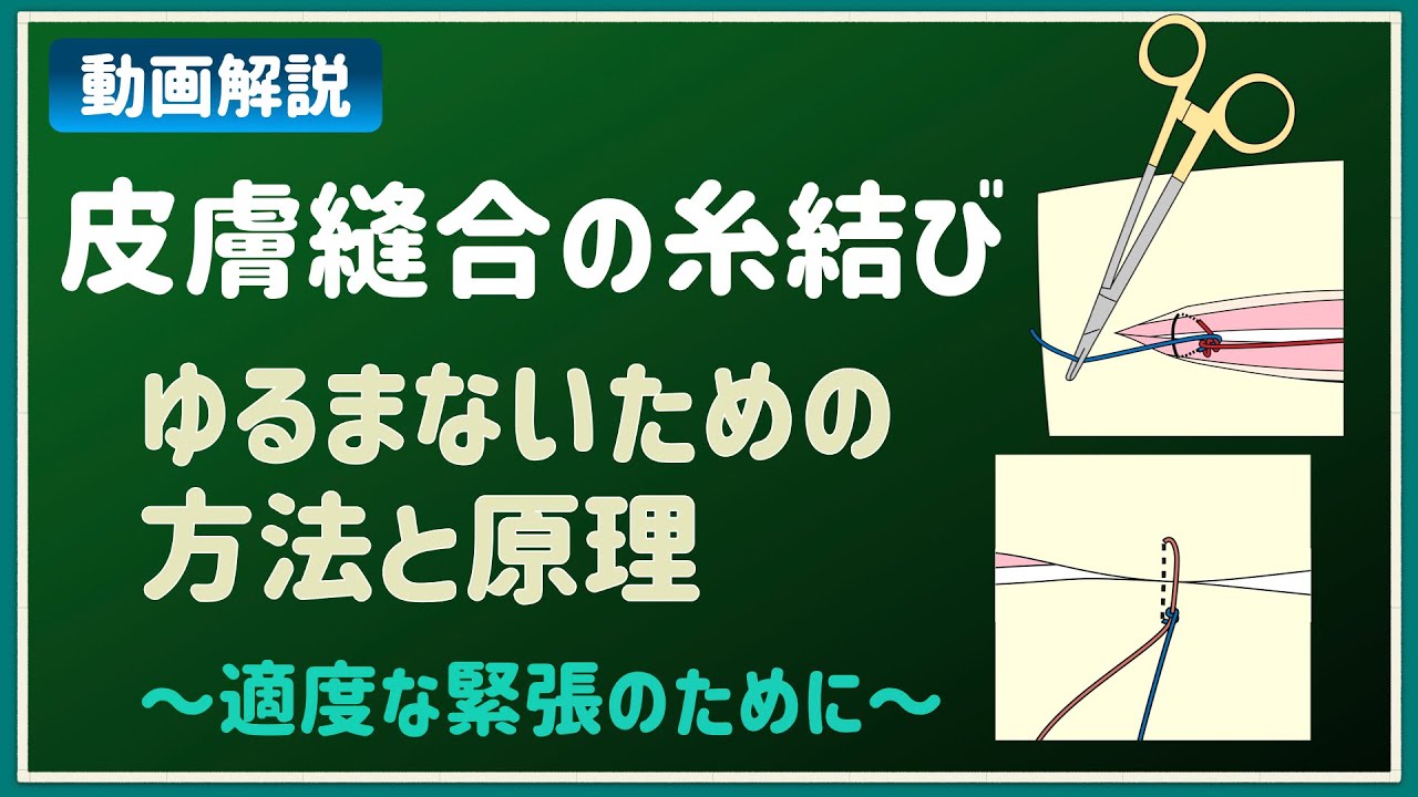 外科手術、救急外来での皮膚縫合と糸結びのコツ　ーゆるまない縫合のためにー