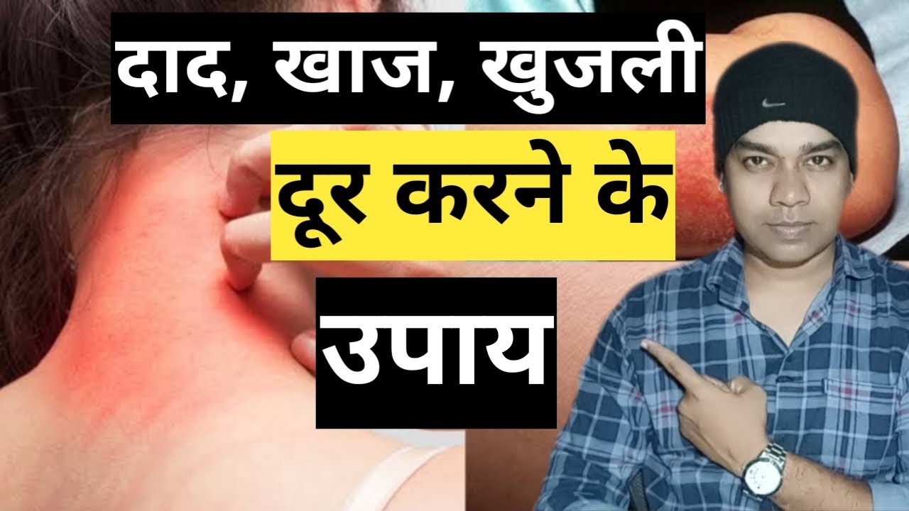 Daad, Khaaj, Khujli door karne ke upay