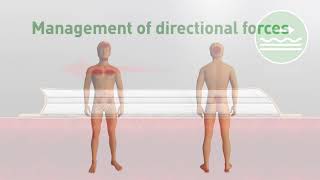 Mölnlycke Pressure Ulcer Prevention Animation