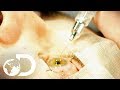 LASER EYE SURGERY | How It's Made