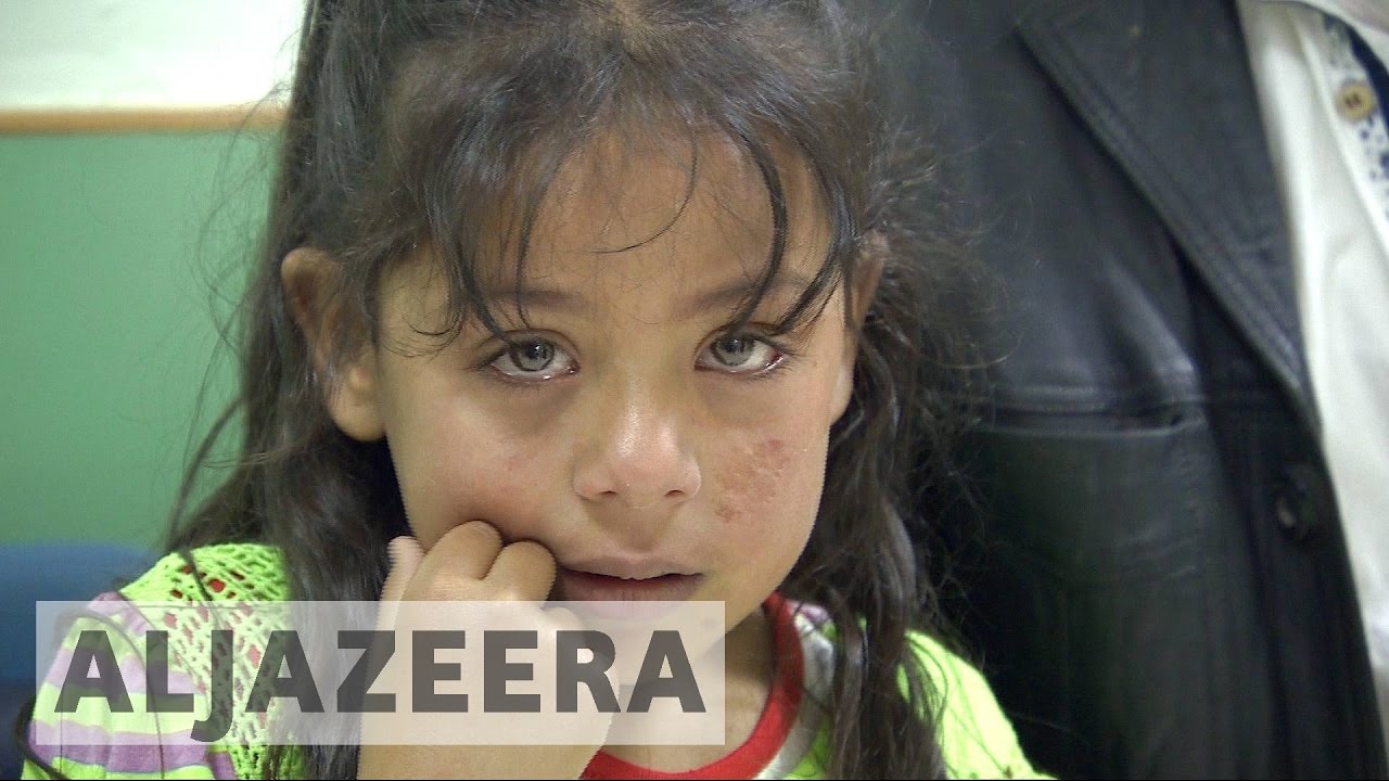 لبنان: مخاوف من انتشار مرض "دمامل حلب"