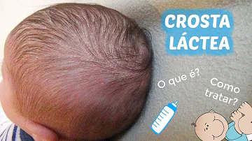 Qual a característica Anatomofisiológicas do RN?