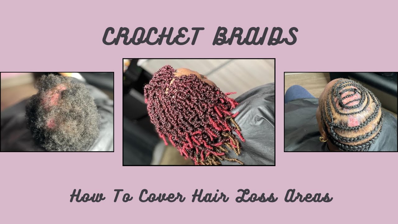 Crochet Braids How To Cover Hair Loss Areas YouTube