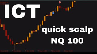 quick scalp in Nasdaq 100 | Nasdaq Live Trade Execution