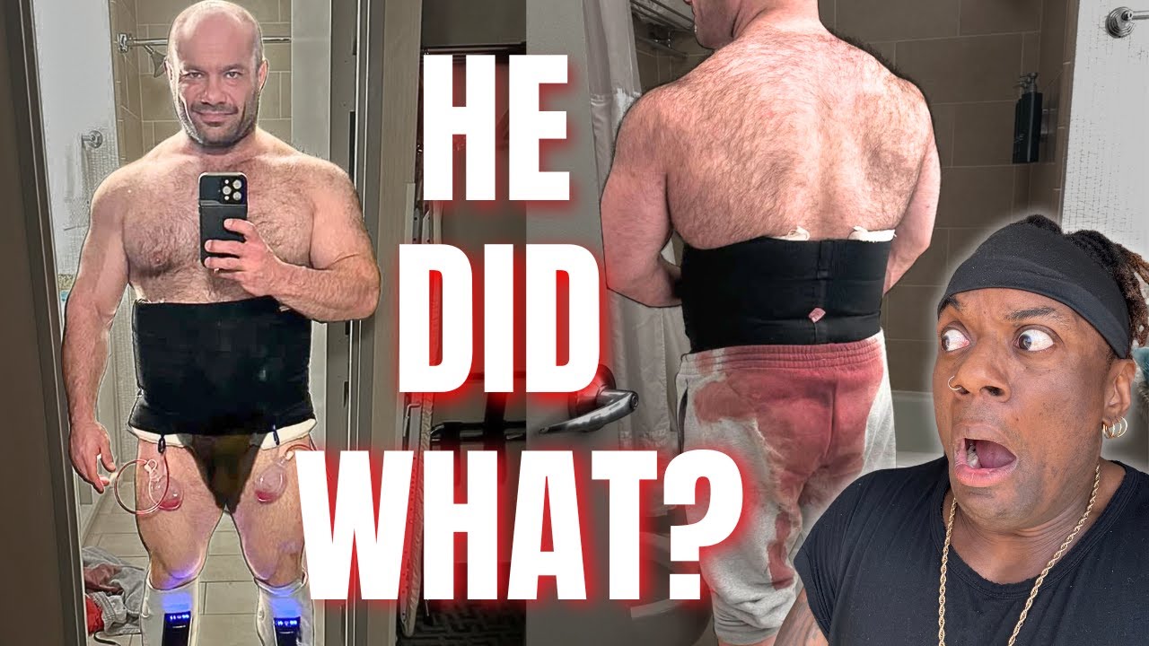 Mike Israetel's Cosmetic Surgery Nightmare | Harder Than Prep?