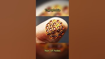 Thumbnail of Trypophobia 👹 #shorts #scary #trypophobia